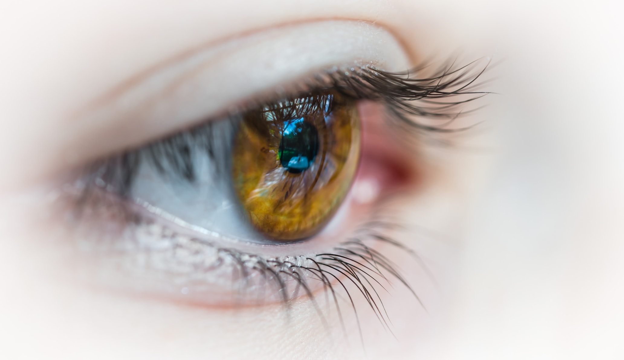 Signs Of Dry Eye Disease : Heavy eyelids